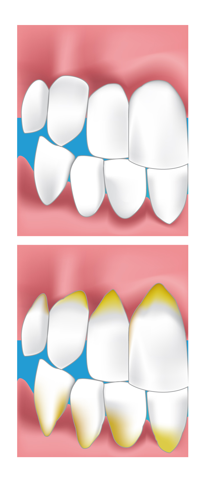 parodontie dentaire paris 20